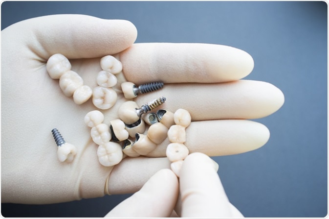 Variety of dentures. Image Credit: Golubovy / Shutterstock